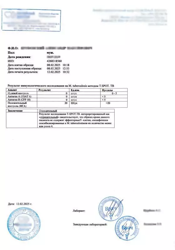 Купить анализ T-spot.